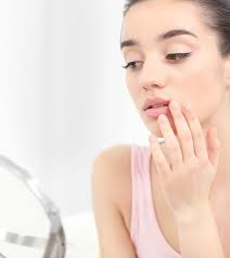 7 natural treatments for sunburned lips