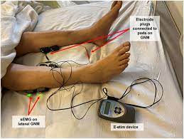Frontiers | Safety and efficacy of electrical stimulation for  lower-extremity muscle weakness in intensive care unit 2019 Novel  Coronavirus patients: A phase I double-blinded randomized controlled trial