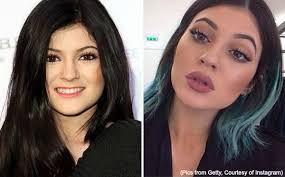 afraid of lip fillers about face