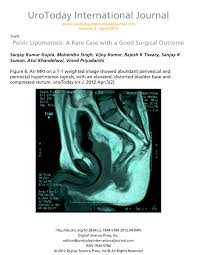 pelvic lipomatosis a rare case with a