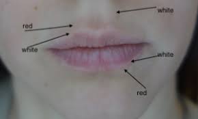 white line around the lips rebecca wood