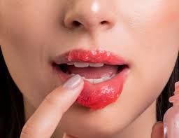 dry and chapped lips learn the causes