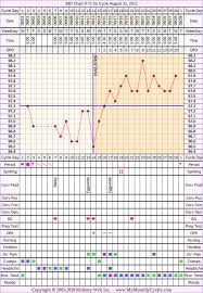 Bbt Chart Examples Pcos Metformin