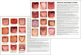 Tongue Diagnosis Chart Tongue Health Health Chart Health