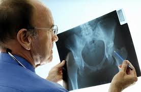 Show orthopedic doctor near me. Orthopedic Surgeons Seven Things You Need To Know Penn Medicine