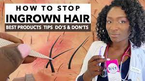 prevent ingrown hairs after waxing
