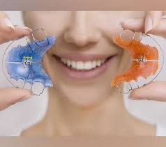 Your specific dental condition will also have an effect on how long it will take your braces to typically, she/he will advise you to wear a retainer for a few months to ensure that your teeth stay in alignment. An Orthodontist Answers Do Teeth Hurt After Braces Are Removed Bruce Orthodontics Rhinelander Wi