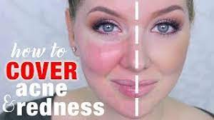 cover acne redness makeup