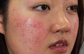 cosmetic allergies