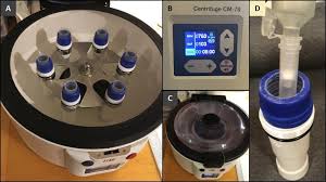 diy centrifugation based purification