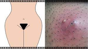 Now we can get into the process of shaving your pubes. How To Shave Your Pubic Hair Without Getting Razor Bumps Healthy Living Tips