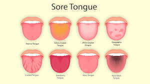 signs your tongue gives about your