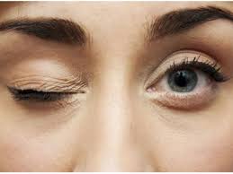 eye twitching causes and how to treat