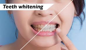 teeth whitening in adobe photo