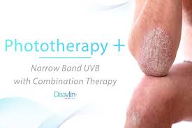 Joint Phototherapy Guidelines Week Three Combination Therapy With Narrow Band Uvb Daavlin