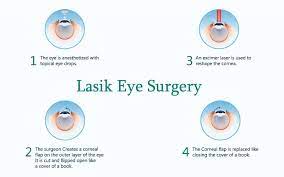 Any past injuries or underlying conditions like cataracts or glaucoma, can hurt your chances of lasik eligibility. Lasik Eye Surgery Near Boynton Beach Lake Worth Fl