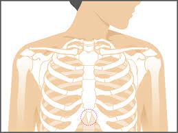 The diaphragm is the muscle beneath the lungs which regulates our breathing. Xiphoid Process Pain Lump Removal And More