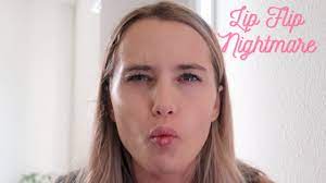 lip flip botox gone wrong you