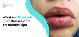 p on lips causes and treatment tips