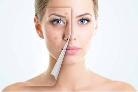 Resultado de imagen para imagen manchas en la piel