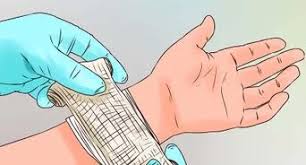 Graze gunshot wounds (those that strike the skin surface in a tangential fashion) are not uncommon. How To Treat A Graze 14 Steps With Pictures Wikihow