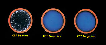 C Reactive Protein Crp Test Introduction Principle