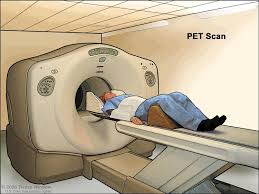 Image result for pet scan