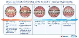 Brushing Your Teeth Saxe Orthodontics