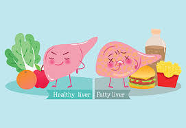 Diet Chart For Fatty Liver Grade 2 In Hindi Fatty Liver