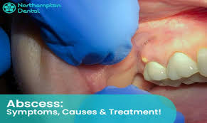 learn in detail about dental abscess
