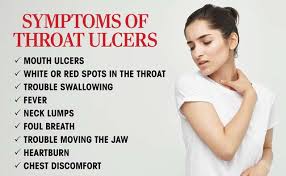 home remes for throat ulcer