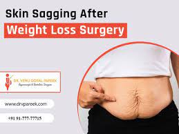skin sagging after weight loss surgery
