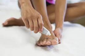 athlete s foot treatment at home