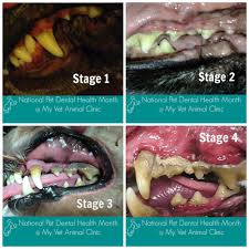 Four Stages Of Periodontal Disease Preventive Care And