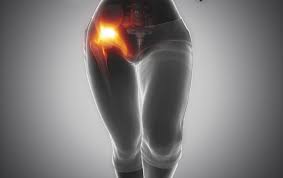 Bildresultat för fibromyalgia hip pain