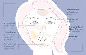face mapping for acne recurring