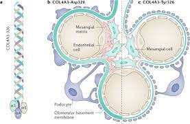 type iv collagen and diabetic kidney