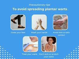 are plantar warts conious