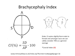 Plagiocephaly Measurement With Craniometer Diagnosis