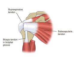 subscaris shoulder pain
