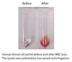 p5w7 101bio red blood cell lysis buffer