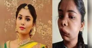 kannada actress swathi sathish face