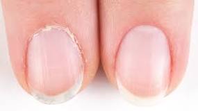 what-happens-if-you-dont-push-back-your-cuticles