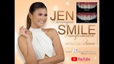 Ms Jen Barangan Smile transformation vlog - YouTube