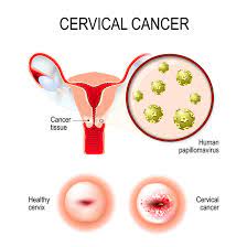 pap smear overview indications