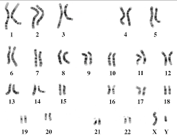 a karyotype of a human genetic male