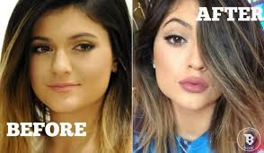 7 langkah makeup bibir ala kylie jenner