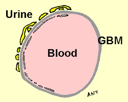 glomerular basement membrane disorders