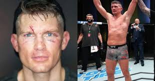 Stephen wonderboy thompson is an american professional mixed martial artist in the ufc welterweight division. Stephen Thompson Gives Update On Knee Injury Suffered At Ufc Vegas 17 Middleeasy
