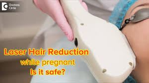 is laser hair reduction safe can it be